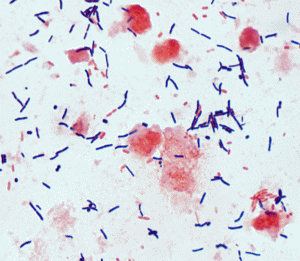 clostridium difficile